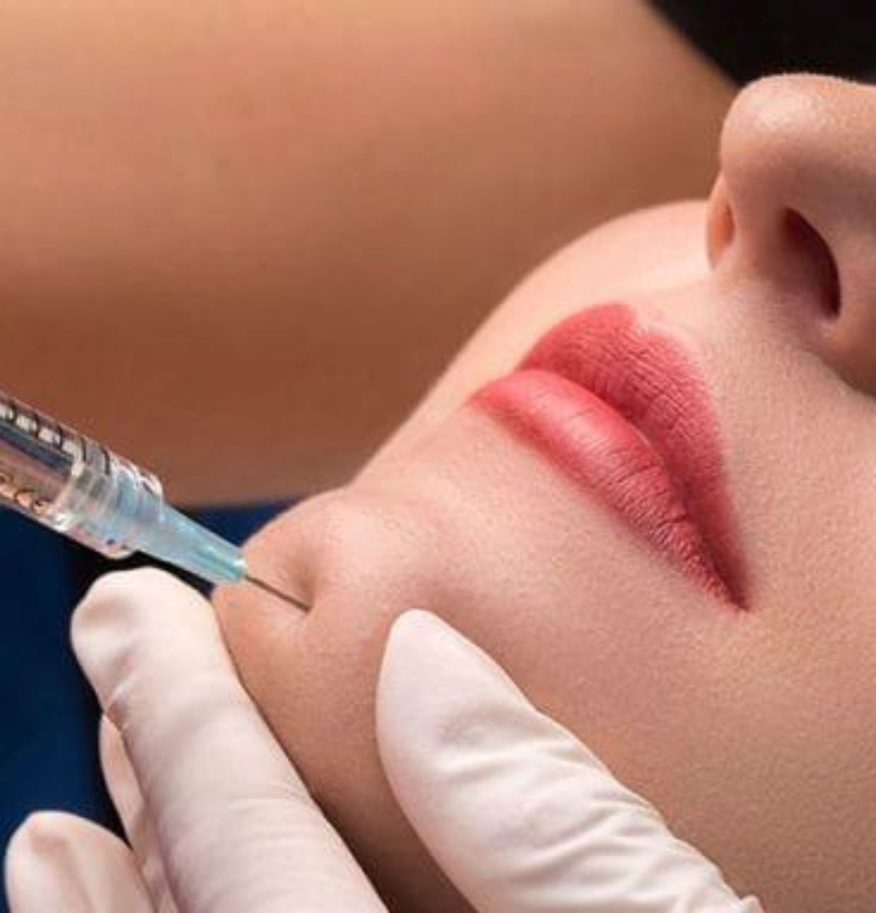 Non-Surgical Facial Enhancements